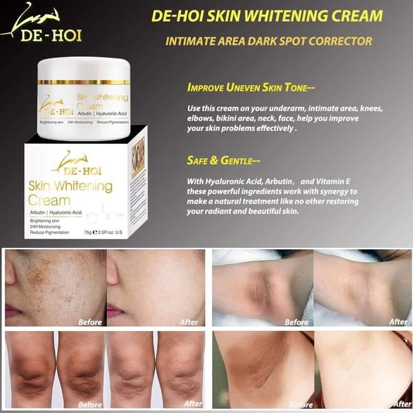 De Hoi Skin Whitening Cream 75g – Brightening & Moisturizing Face & Body Cream for Dark Skin