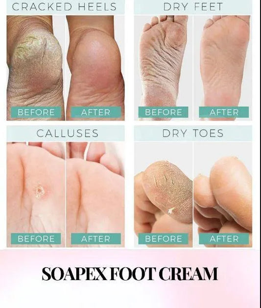 Nourishing Foot Cream – Repair Dry, Cracked Heels & Soften Feet (1 Pc)