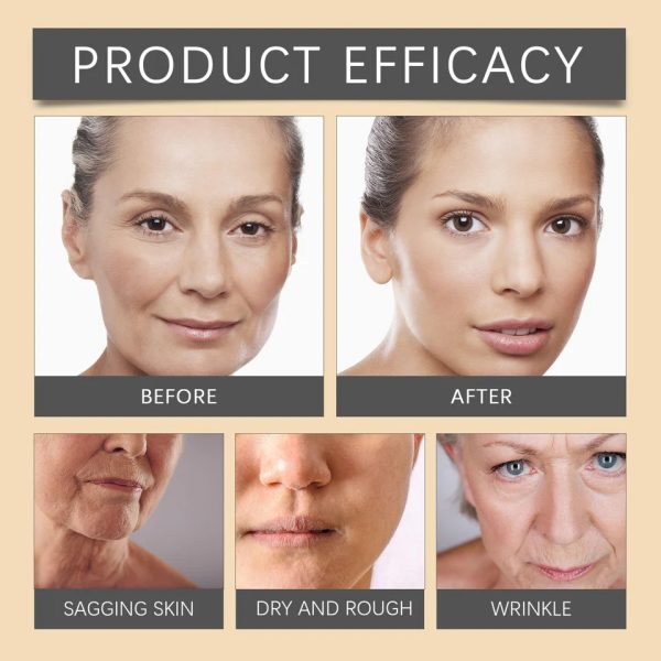 Bee Venom Whitening & Moisturizing Face Cream – Brightening Anti-Aging Hydrating Skincare Moisturizer